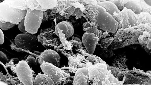 Electron microscope image of Yersinia pestis, the bacterium that causes plague